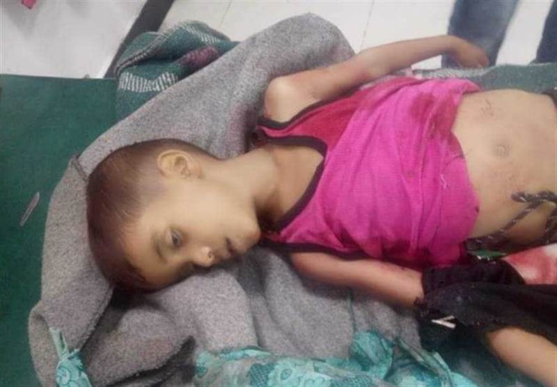 Taiz’de Husilerin bombaladığı evde bir çocuk yaşamını yitirdi