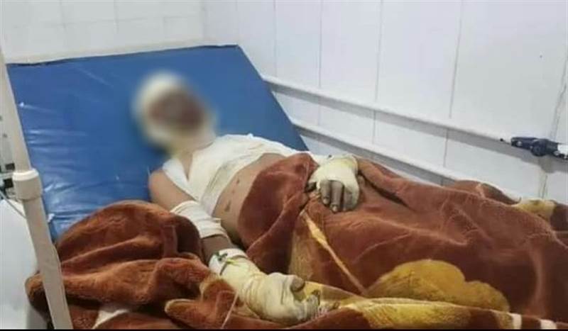 وفاة مواطن بعد إحراق نفسه داخل إدارة أمن مديرية العدين بمحافظة إب