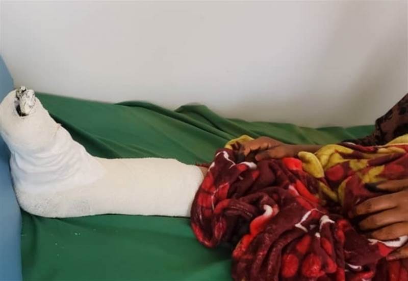 مركز حقوقي يدين استمرار سقوط ضحايا بنيران مليشيات الحوثي بمحافظة تعز
