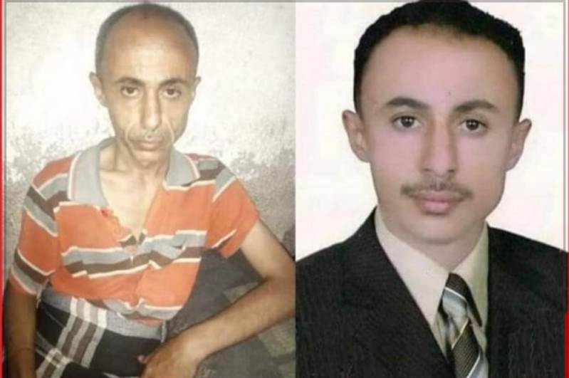 Husiler işkence sonucu sağlığı kötüleşen gazeteciyi serbest bıraktı