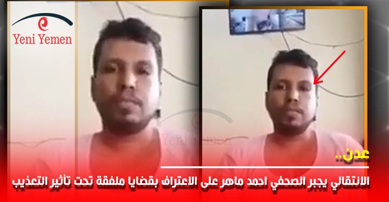 مليشيات الانتقالي الإماراتي تجبر الصحفي احمد ماهر على الاعتراف بقضايا ملفقة تحت تأثير التعذيب (فيديو)