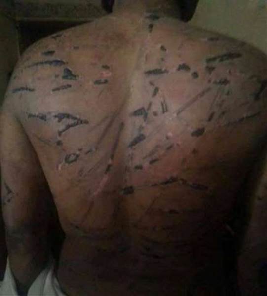 توثيق اكثر من 17 الف حالة تعذيب جسدي ونفسي في سجون ميليشيات الحوثي