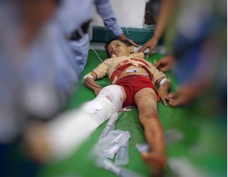 Yemen’de ateşkes sürecinde Taiz’de Husi saldırılarında 74 sivil öldü ve yaralandı