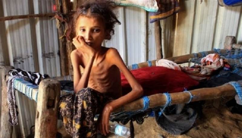 ABD ajansı: Yemen’de açlığı önlemek için ateşkesin uzatılması gerekiyor