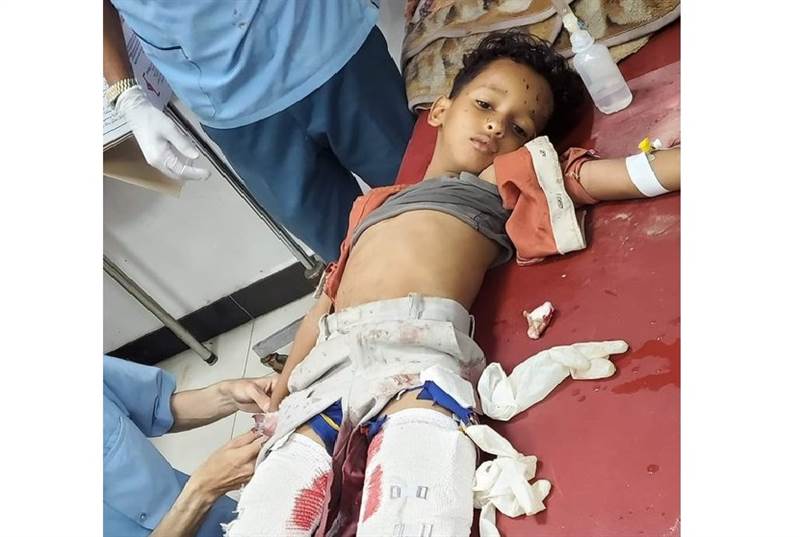 بعد ساعات من مقتل والده.. وفاة طفل متأثرا بإصابته بقذيفة حوثية في تعز