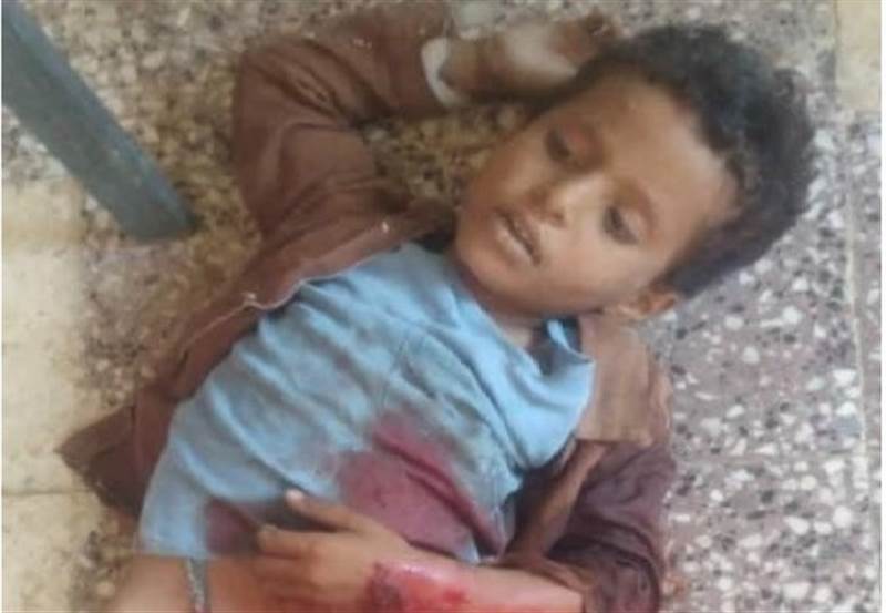 Yemen’de Husilerin bombardımanında bir çocuk öldü, çok sayıda kişi yaralandı