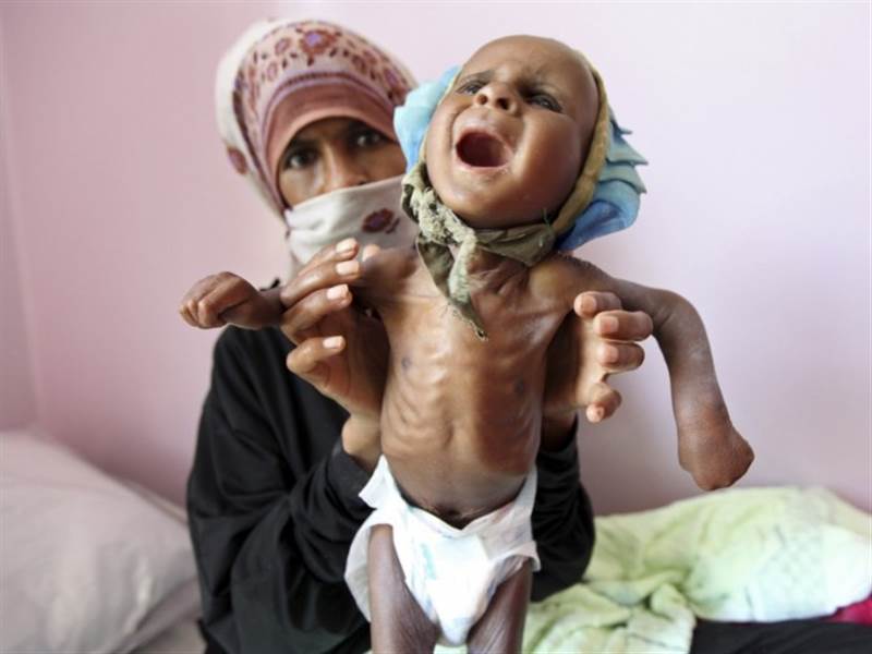 مسؤولة أممية: الجوع لا يزال يطارد أكثر من نصف السكان في اليمن