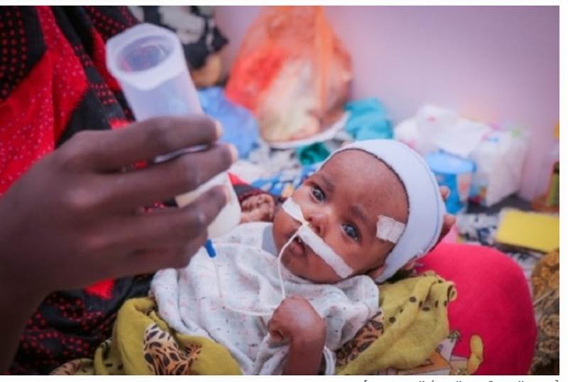 ABD’den Yemen’e yetersiz beslenme ile mücadelede  4.8 milyon dolarlık destek