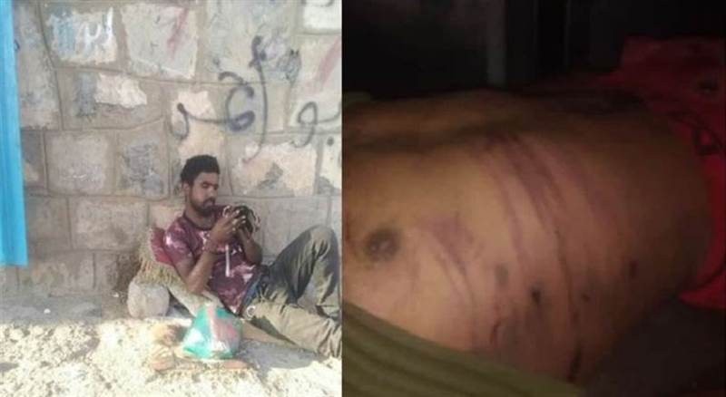 Yemen’de BAE destekli GGK milisleri bir genci işkence ederek öldürdü