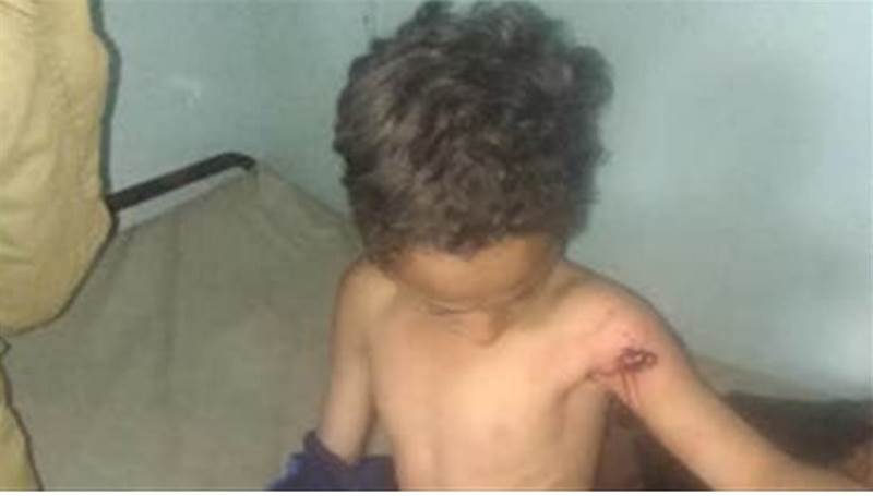 Taiz'de Husi keksin nişancının hedef aldığı 2 çocuk yaralandı