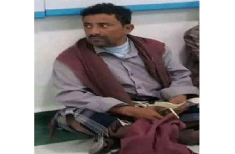 الضالع.. مليشيات الحوثي تعدم مواطن بطريقة غامضة بعد ساعات من اختطافه