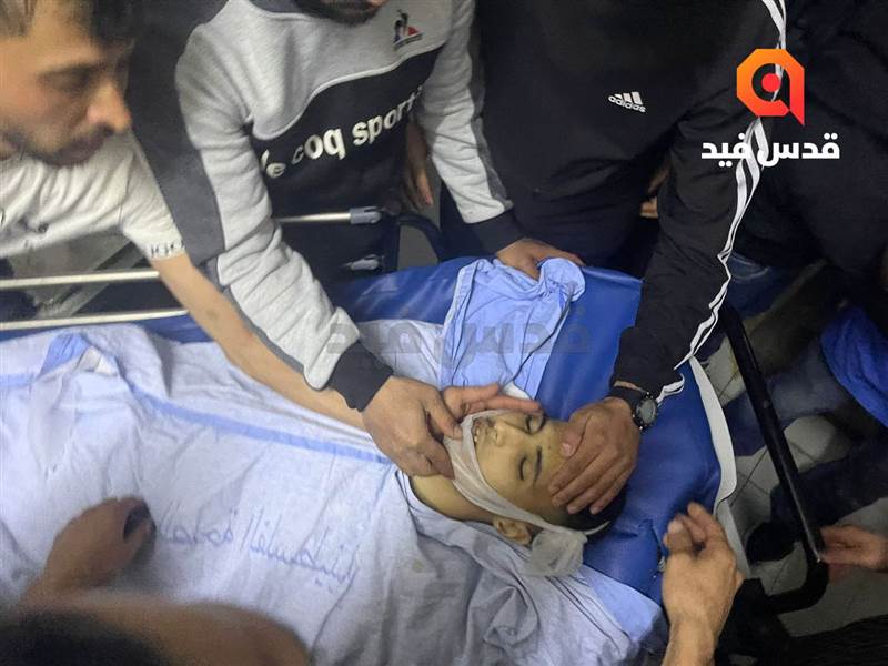 استشهاد وإصابة 3 فلسطينيين برصاص قوات الاحتلال الإسرائيلي شرق قلقيلية