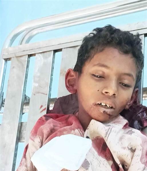 مقتل طفل إثر قصف طيران حوثي مسير بمحافظة الحديدة