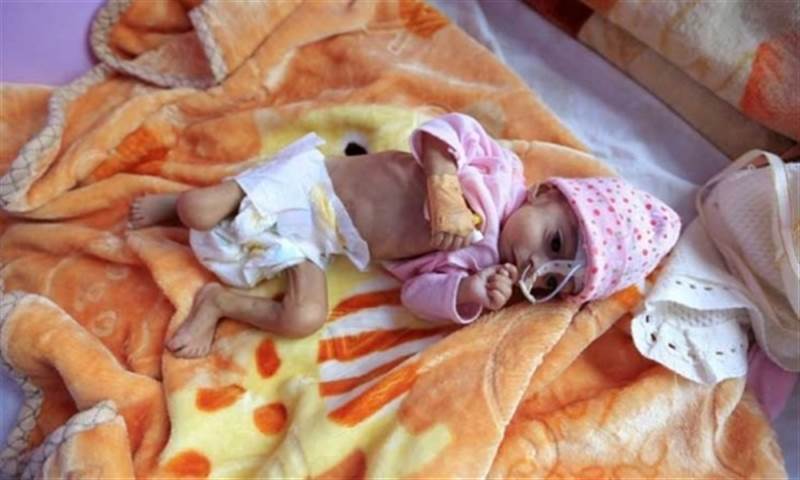 الملايين منهم باتوا على حافة الموت.. من يجنب أطفال اليمن شبح مجاعة محدقة؟