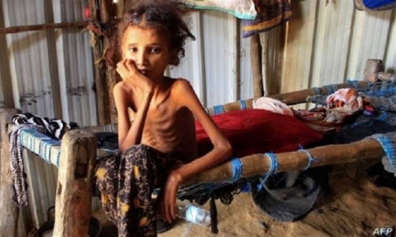 Ekonomik çöküş ve finansman eksikliği en önemli nedenler.. Birleşmiş Milletler, Yemen'deki insani krizin şiddetleneceği konusunda uyardı