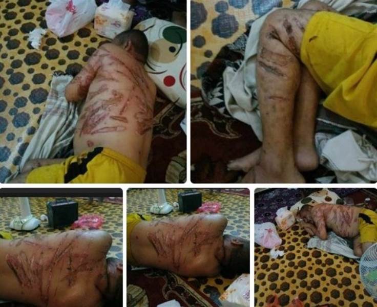 Yemen’de BAE destekli GGK hapishanesinde işkence gören akıl hastası yaşamını yitirdi