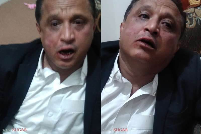 عصابة حوثية تعتدي بالضرب على الصحفي ”مجلي الصمدي” بصنعاء