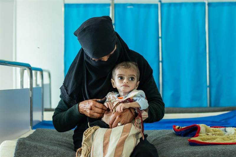 الصحة العالمية تقول انها انقذت 100 طفل يمني من الهزال