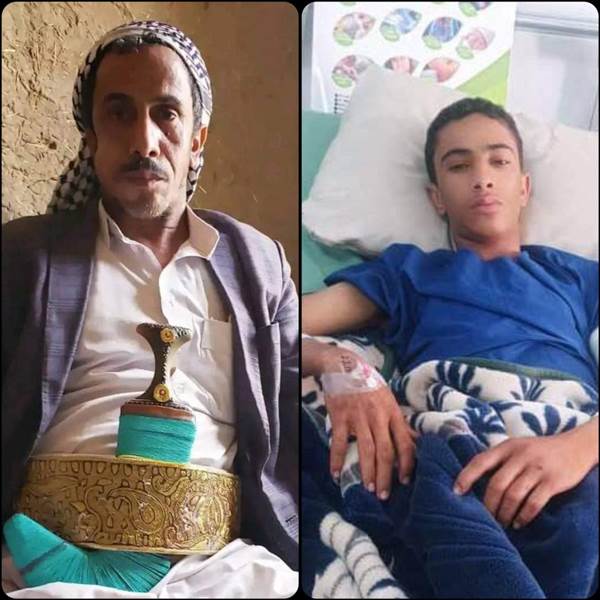 مقتل شيخ قبلي واصابة 3 من افراد عائلته بمحافظة عمران