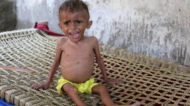 BM: Yemenlilerin yarısı gıda güvensizliğinden muzdarip
