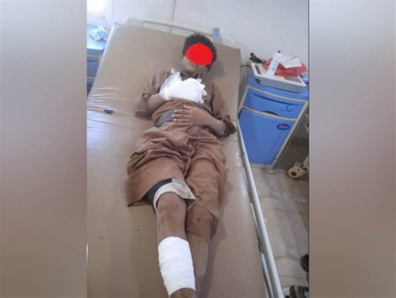 إصابة طفل بانفجار لغم حوثي بمحافظة مارب