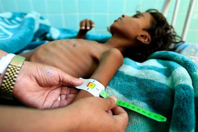 UNICEF’ten Yemen'de salgın hastalıklarla mücadele için 26 milyon dolarlık proje