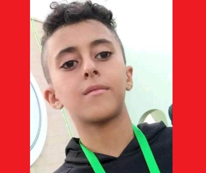 مقتل طفل في صنعاء والسبب كيلو دقيق تالف.. تفاصيل