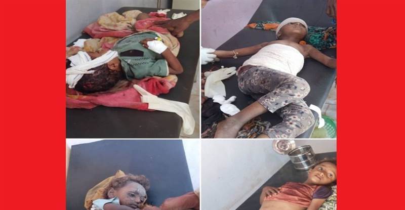 New Massacre in Taiz: Houthi Shelling Kills One Child and Injures Three Others"