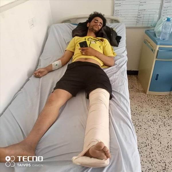 قناص حوثي يصيب مدنياً في الضالع أثناء عمله بمزرعته وسط تصعيد ممنهج ضد المدنيين
