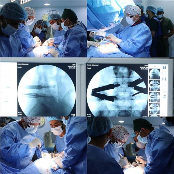 إنجاز طبي غير مسبوق في عدن.. عملية دقيقة للعمود الفقري دون فتح جراحي