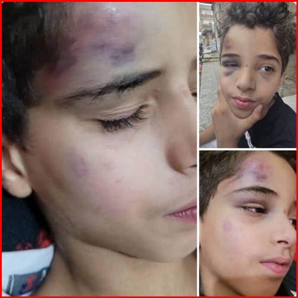 ركلاً بالأقدام.. عنصران حوثيان يعتديان بوحشية على طفل في وسط صنعاء