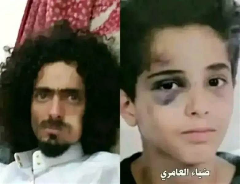 اعتقال المعتدين على طفل القادسية في صنعاء بعد موجة غضب شعبي