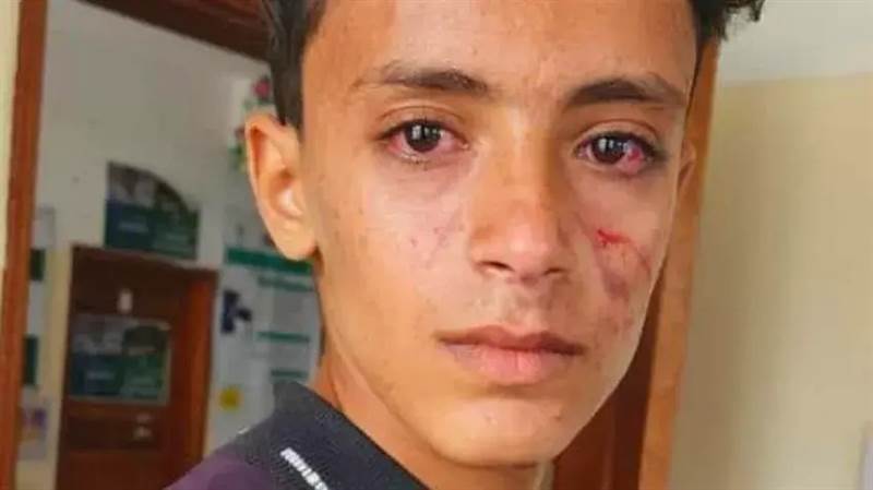 اعتداء مروع في ريمة: مشرف حوثي يضرب طفلًا ووالدته ويسبب موجة غضب بين الأهالي